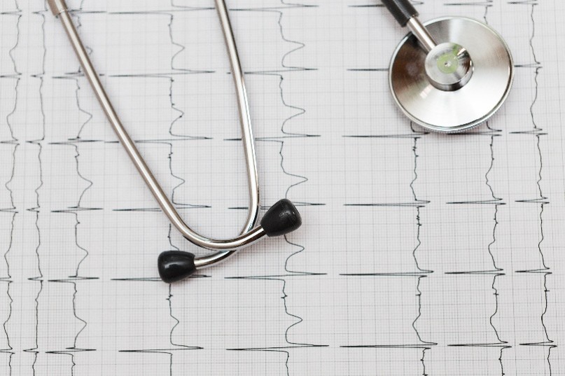 Generalidades del ECG